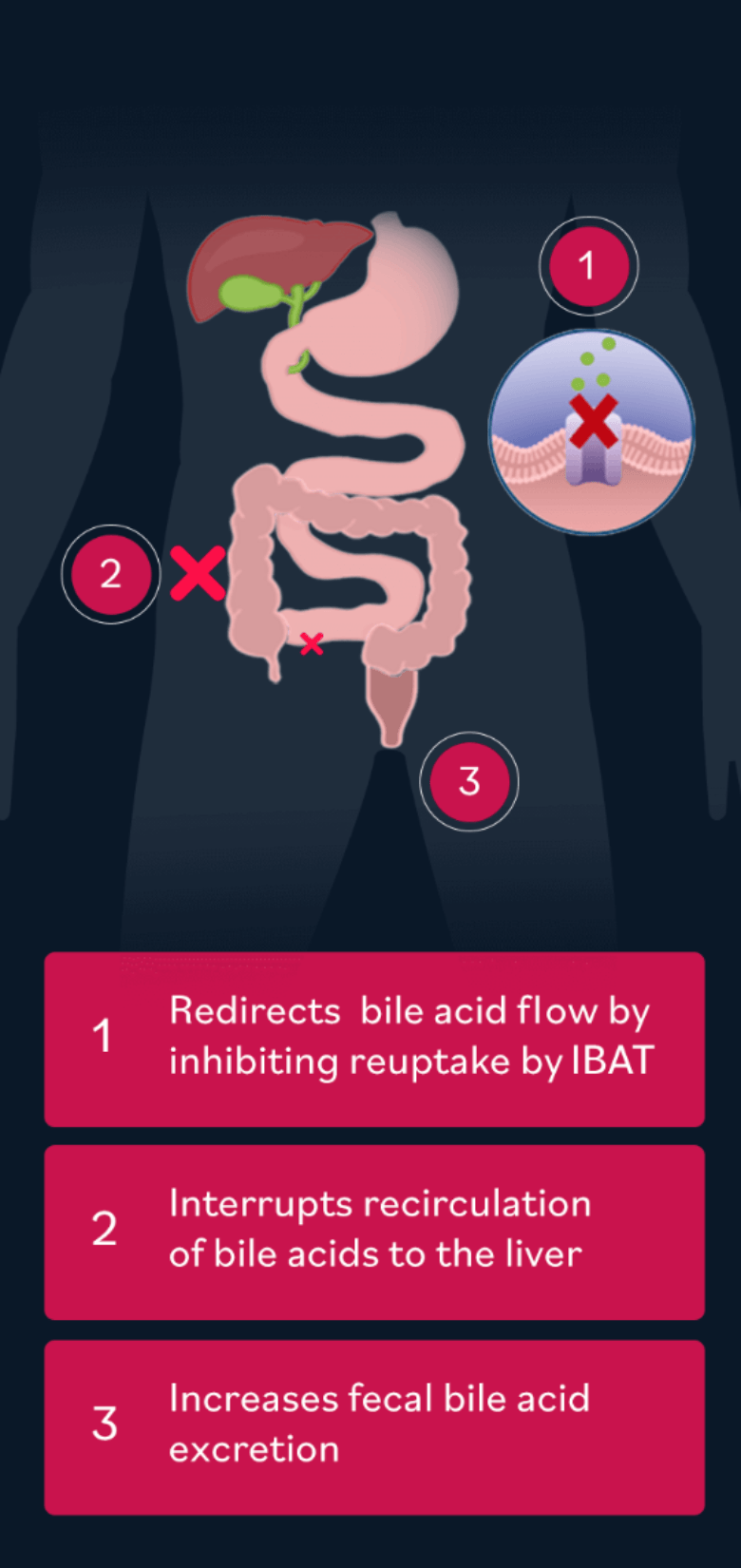 Redirecting bile acid flow through ileal bile acid transporter (also known as IBAT) inhibitors helps to increase fecal bile acid exretion and interrupts recirculation of bile acids to the liver, showing promising results in rare liver disease.